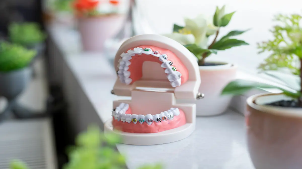 Ortodoncia dental